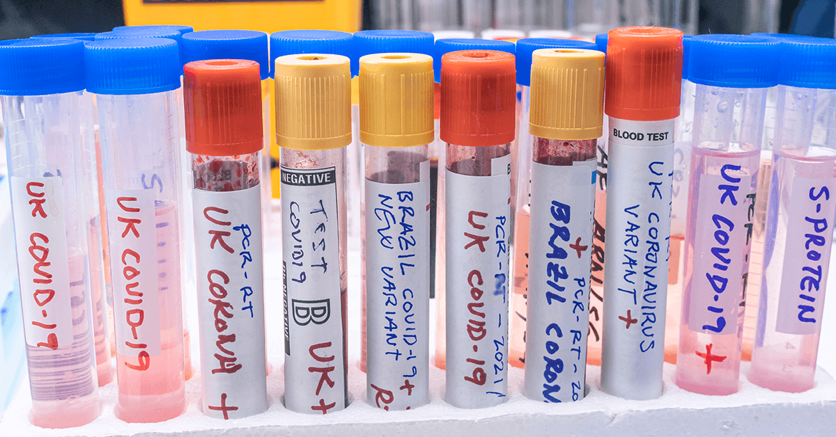A set of tubes containing different COVID-19 variants