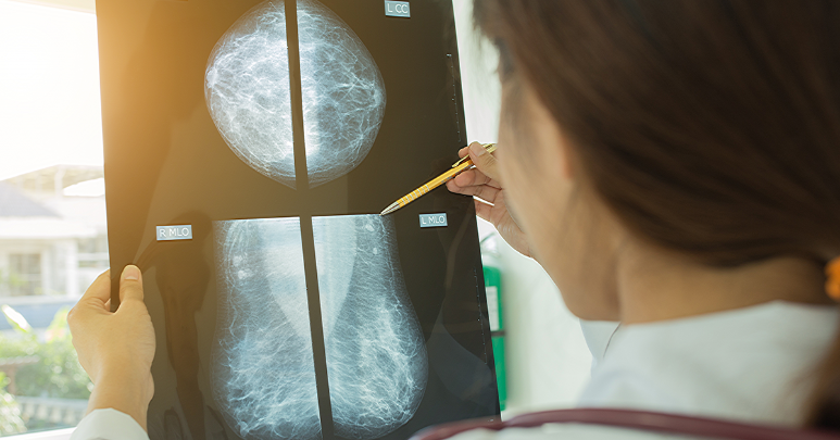 Female breast oncologist reviews the scans from a mammogram.